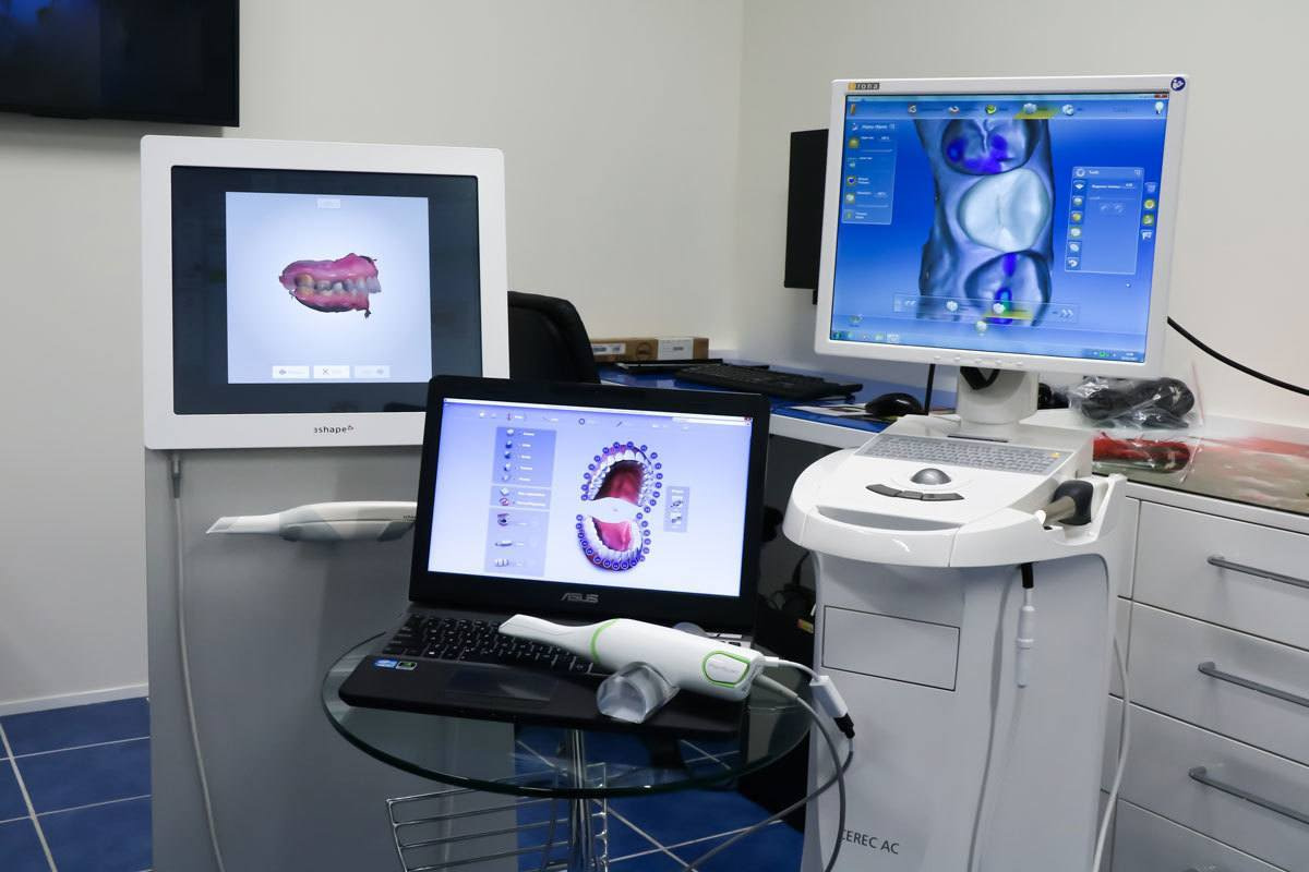 CEREC Same-Day Crowns - equipment