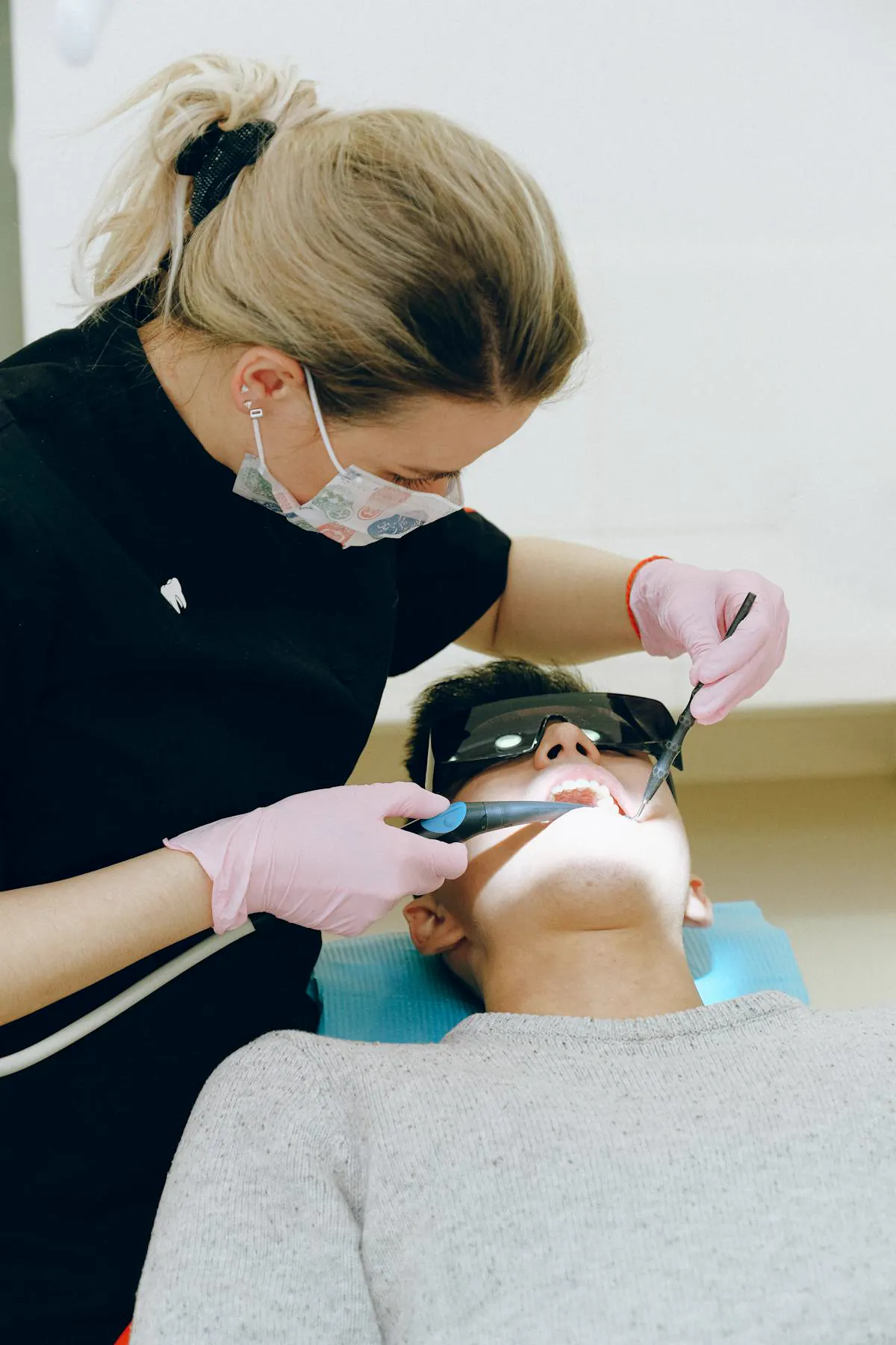 Fissure sealant application on a child's tooth
