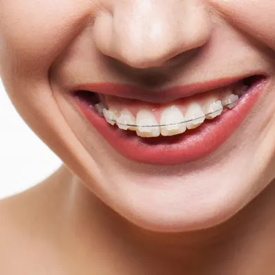 Orthodontics