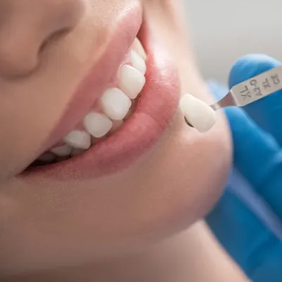 Restorative Dentistry