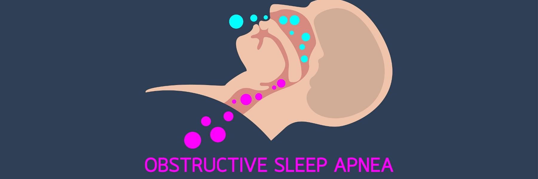 Sleep Apnea Diagram | Tamworth Dentist