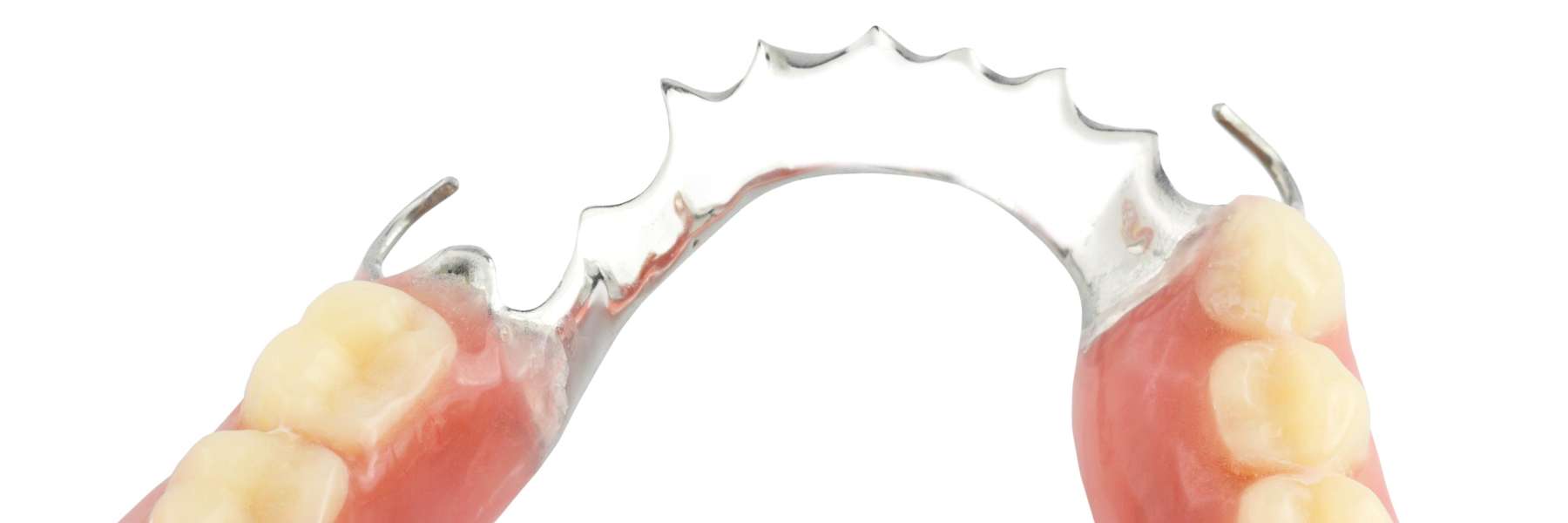 Partial Dentures in Tamworth NSW