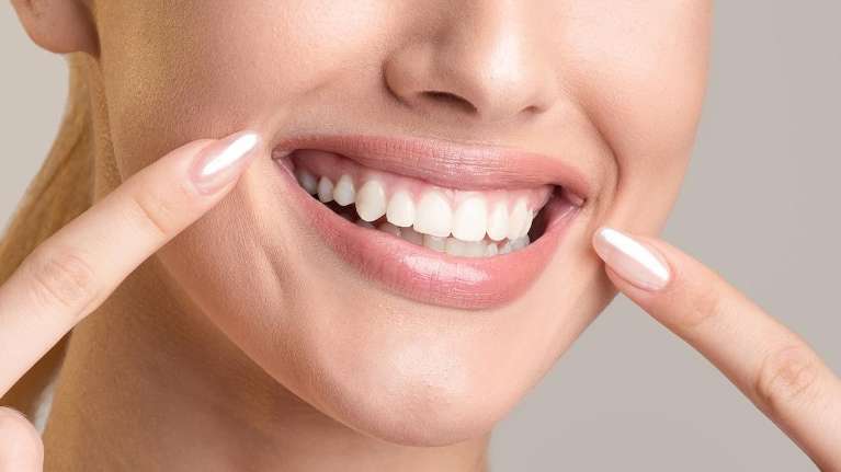 Smiling woman showing her perfect white teeth after dental treatment