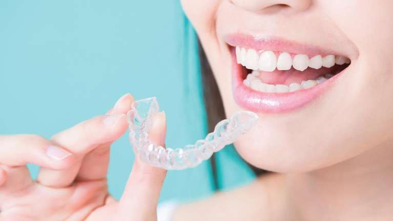 Woman holding an Invisalign tray